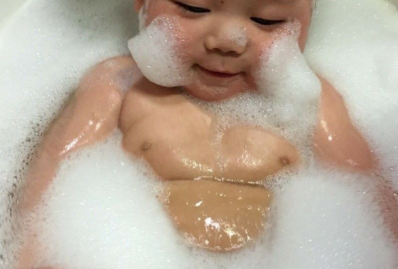 It's not uncommon for babies, who have sensitive skin to have reactions